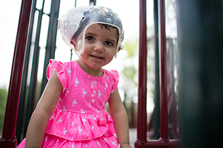 CHAM_Craniofacial_Maira_2014_07-304_316x210